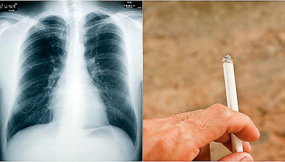 Rökning. Arkivbild. Lungcancer har ett starkt samband med rökning.