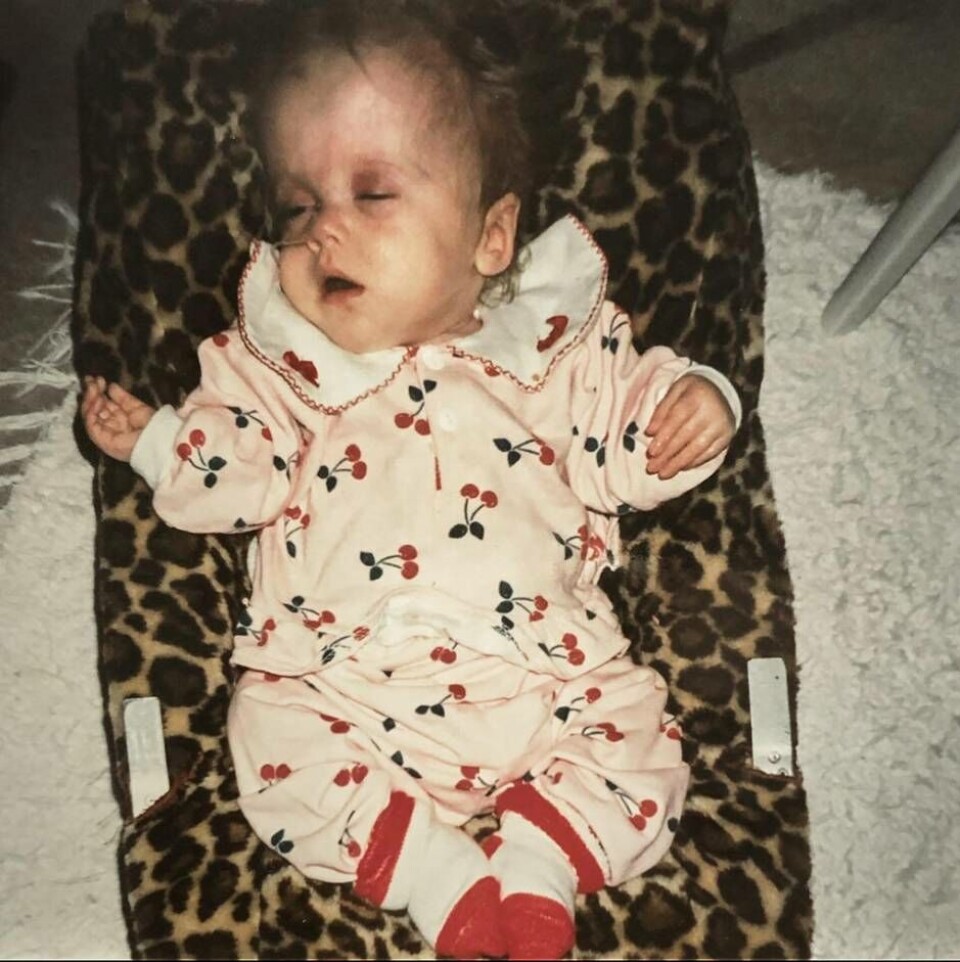 När Louise föddes så var hennes ena arm kurverad i 90 grader och benen var bananformade. Foto: Privat När Louise föddes så var hennes ena arm kurverad i 90 grader och benen var bananformade. Foto: Privat